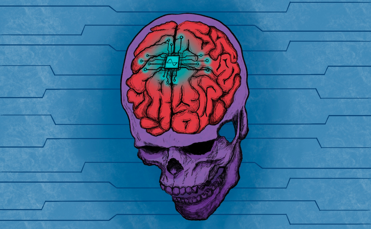 Since its first operation on Arbaugh, Neuralink has performed on 20 patients and expanded its trial sites internationally to the U.K. and Canada. Although the company is not the first or only one exploring brain-computer interface (BCI) technology, its scale of impact on paralysis treatment and the accompanying headline-grabbing controversies have placed Neuralink in the neuroscience spotlight, eliciting both admiration and skepticism.